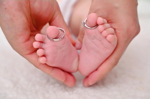 国内试管代生孕妈肚子上的妊娠纹 国内试管代生孕妈肚子上的妊娠纹